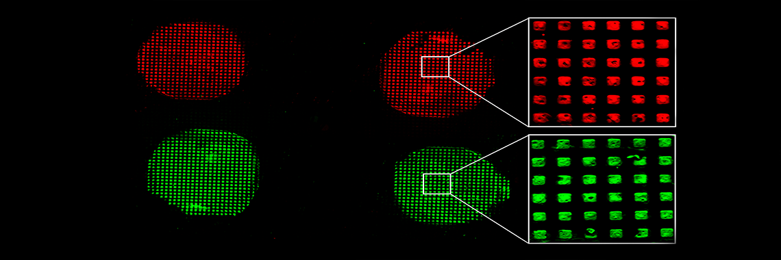 Miniature Technology Big Hope For Disease Detection Miniature Technology Big Hope For Disease Detection